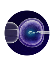 体外受精和胚胎培养